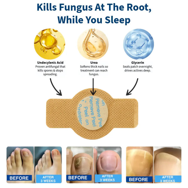 ClearStep Nail Patches